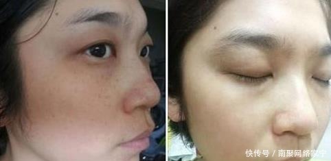 维生素E和它一起敷脸,使用7天美白祛斑,还能淡化细纹!