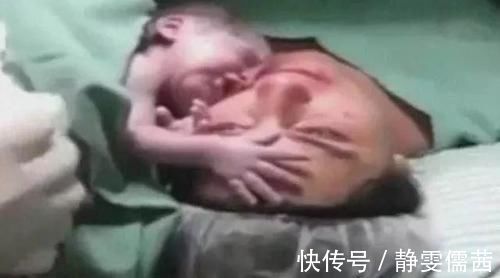 医生|产妇难产心跳停止,婴儿伸手摸妈妈的脸,之后的画面让医生不淡定