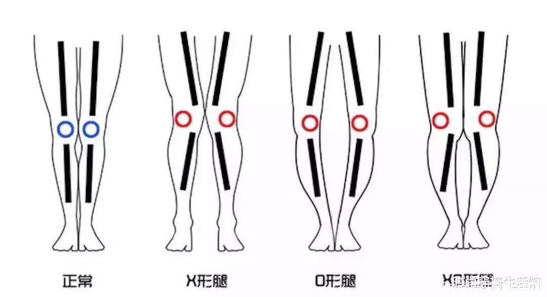 腿型|?腿粗适合穿什么?这4件单品才是真显瘦,太实用了