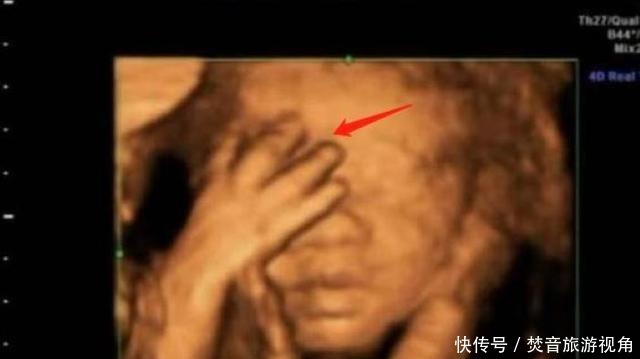 算数|“天才”胎儿走红,还在妈妈肚里就会“算数”,医生清华北大等你