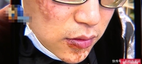 陈赫|陈赫火锅店事故现场:水泥掉下砸进锅内,热油泼得到处都是