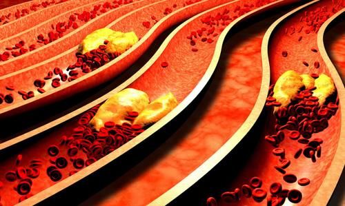 胆固醇|多家医院联合呼吁:1物胆固醇比肥肉高几十倍,再馋也要管住嘴