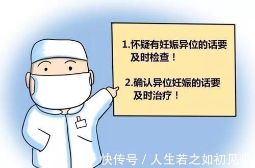 妇产科医生|女人怀上“宫外孕”，多半是男人的锅妇产科医生几句话挑出问题