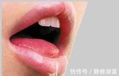 太白穴|不管补气或补血,都得先补脾,补脾就多喝一碗汤,来了解下