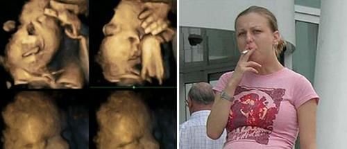 医生|做B超时看见胎儿做鬼脸,孕妈正高兴,医生:孩子恐怕不能要