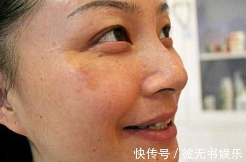 维c|吃维C淡斑等于白吃,真正淡斑的是这3物,早看早知道