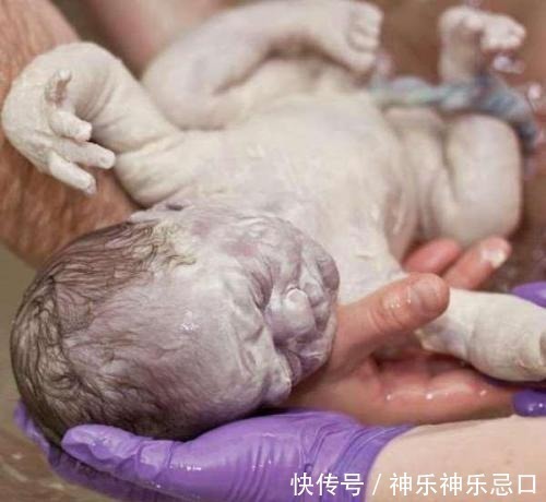孩子|孩子出生像“雪人”,爸妈一看吓哭了,医生却说“恭喜恭喜”