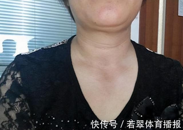 患上甲状腺结节|甲状腺结节不能喝小米粥?想要甲功好,忌“2绿”,做“2事”