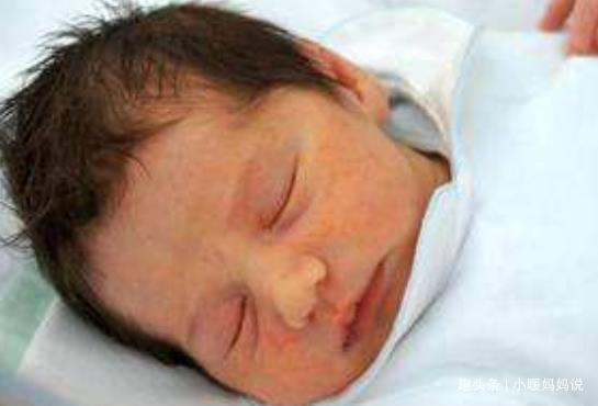 准妈妈们|孕妇十月怀胎,剖腹产2小时竟生出了“怪胎”,医生恭喜你