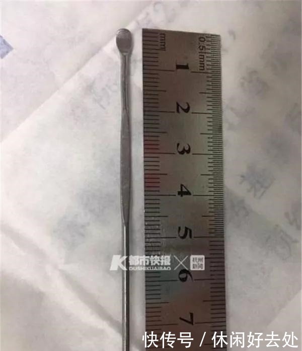 11岁男孩将70颗磁力珠塞尿道，医生呼吁别给孩子买了！