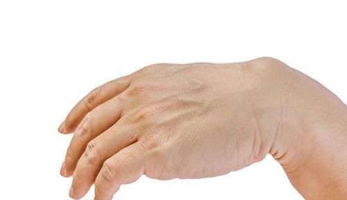 疾病|引发中风的4个诱因,需留意!中风来临前,身体会发出4个信号!