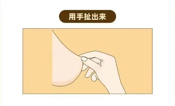 乳腺癌|乳头凹进去了怎么办？会是乳腺癌吗？干货！