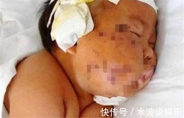 林女士|4年前,因吃奶咬疼妈妈,被妈妈用剪刀划伤脸的男婴,如今咋样了