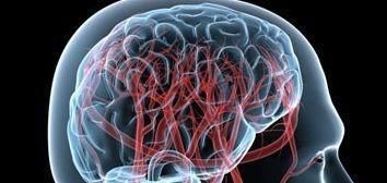  血压控制挺好，一年种却两次脑梗瘫痪在床，因为她犯了5个错