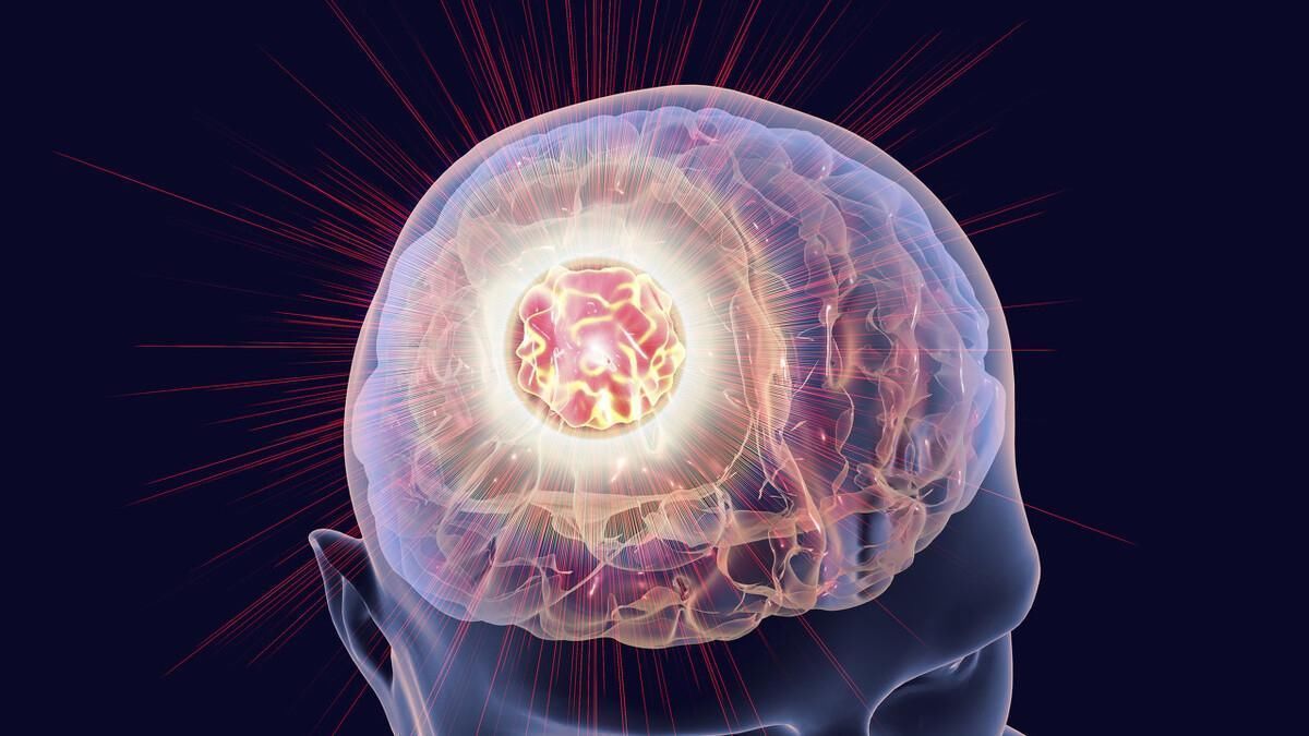 老人|肺癌脑转移只能活6个月,但这位老人已活过5年,他是怎么做到的