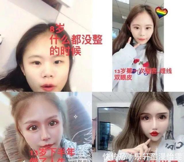 女孩|被整容毁掉的女孩“我的整形医生,只给鸡腿做过手术”