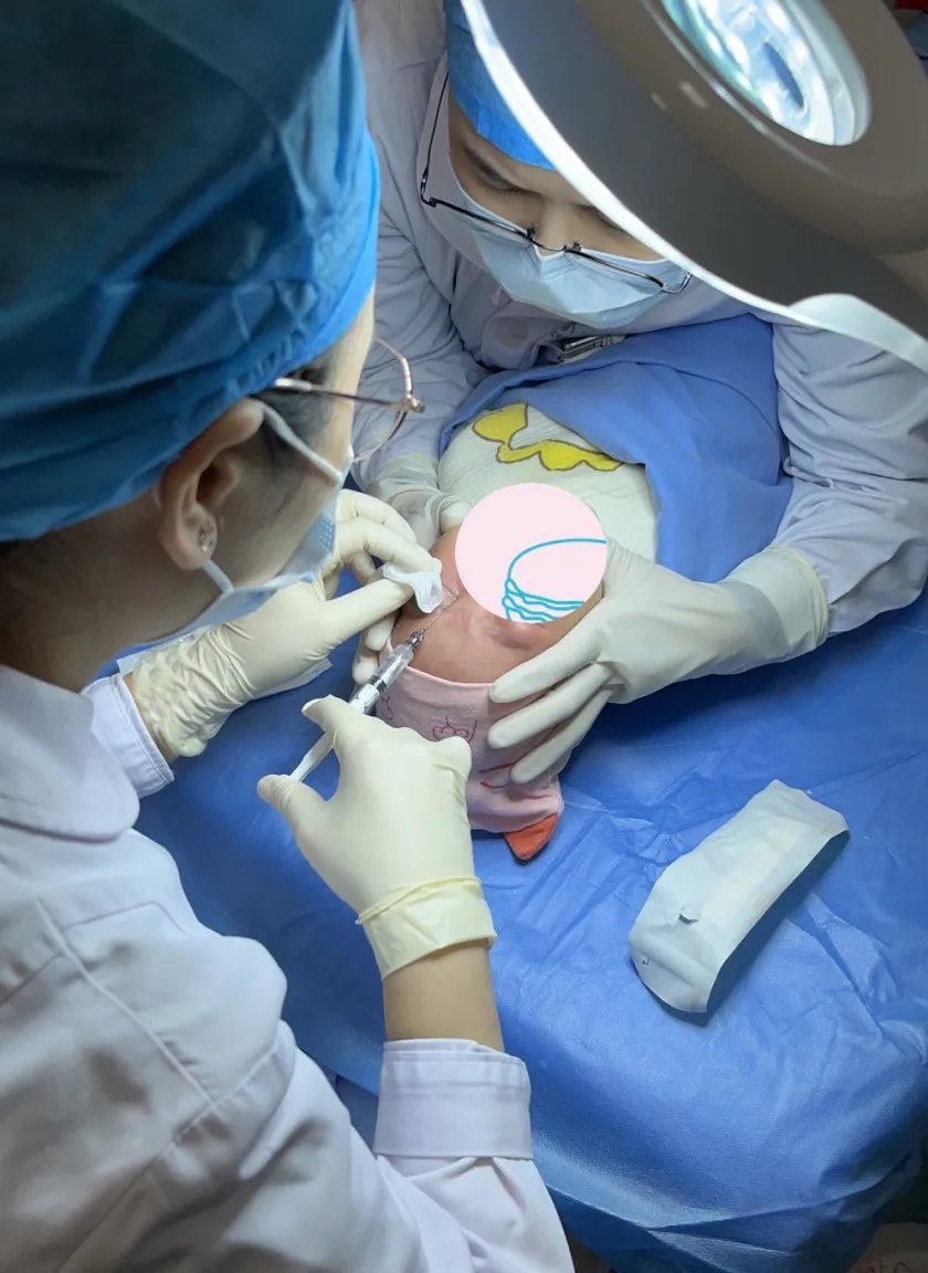 泪道|眼角抽出5管脓液,宝宝眼睛经常“泪汪汪”居然是病!拖延治疗严重的可能失明