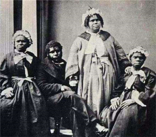 男子被解剖展览,妻子留遗愿别展览我!却仍被送博物馆展览98年