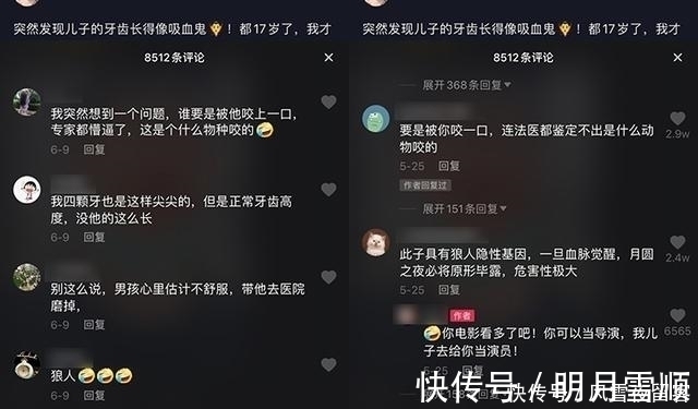妈妈|17岁孩子长尖牙,妈妈以为是假的,亲手摸过后吐槽:像“吸血鬼”
