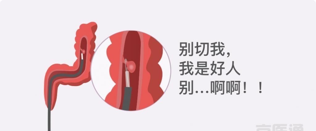 卵巢囊肿|结节、息肉、囊肿是癌症先兆吗?北肿专家们说出了真相!