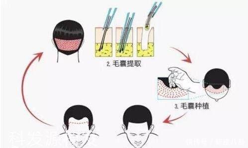 光头|男人过了四十别剃“光头”,三种帅气发型,让油腻大叔变回小鲜肉