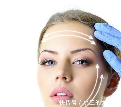 面部 做过3次线雕的她,为什么还要跑来做拉皮手术!