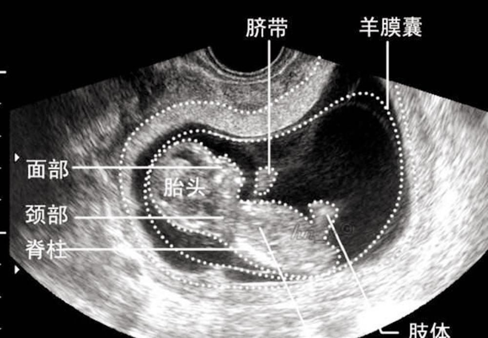 胚胎期|怀孕过了这月,腹中宝宝才算上个真正的“胎儿”,有了生命的意义