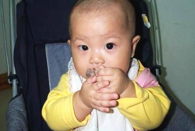 积食|双胞胎长期积食不在意，拖成“疳积”，儿科医生：家长无知造成的