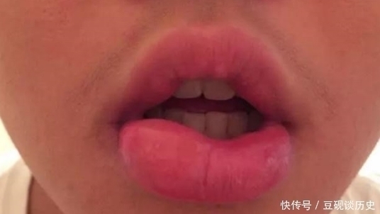 不良习惯|女生有这3习惯？难怪嘴唇“越来越厚”，再不改小心变成“猪圈嘴”！