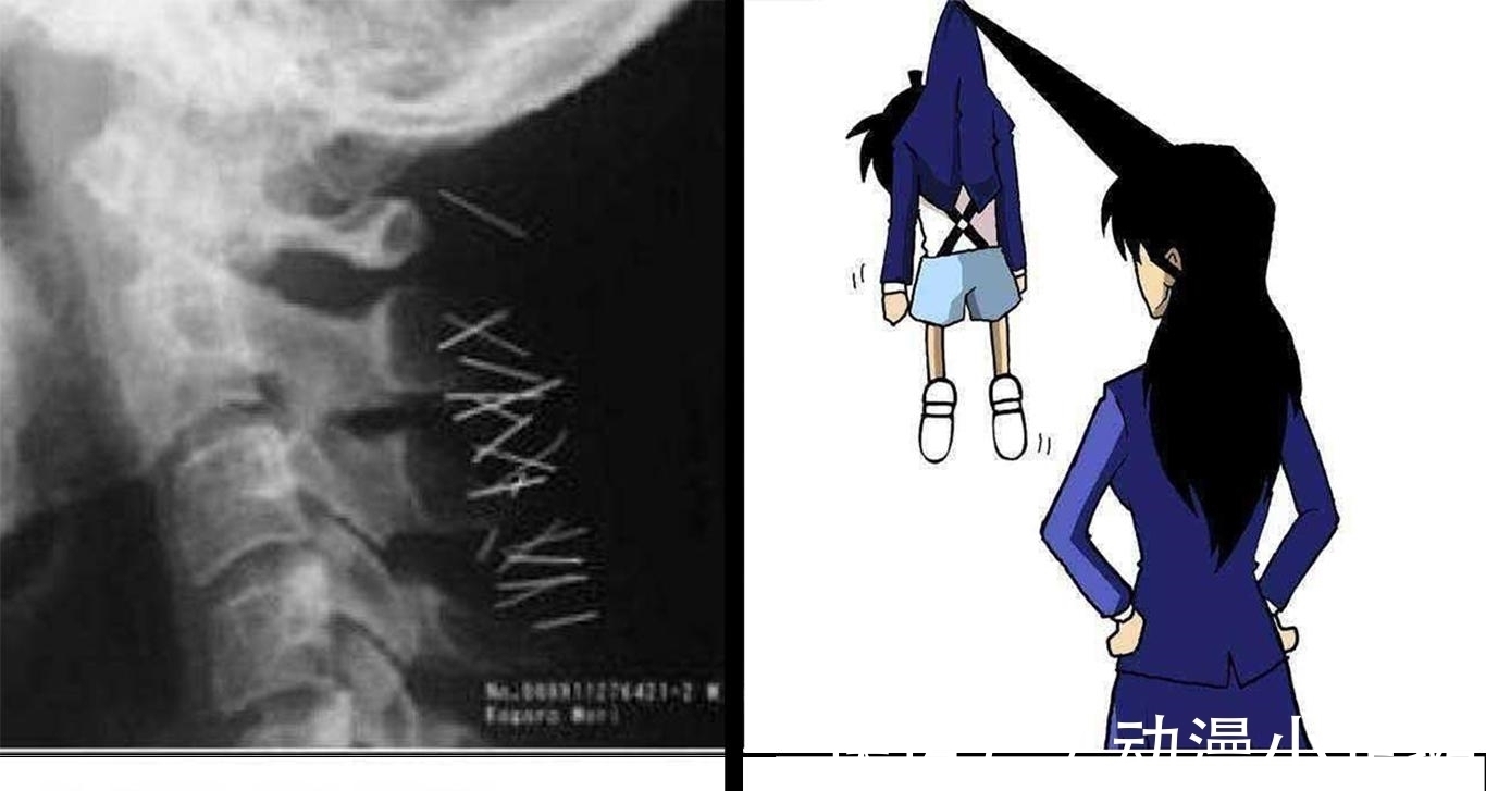 小五郎|《名侦探柯南》中的未解硬梗,难倒众多粉丝,73老师也一脸懵