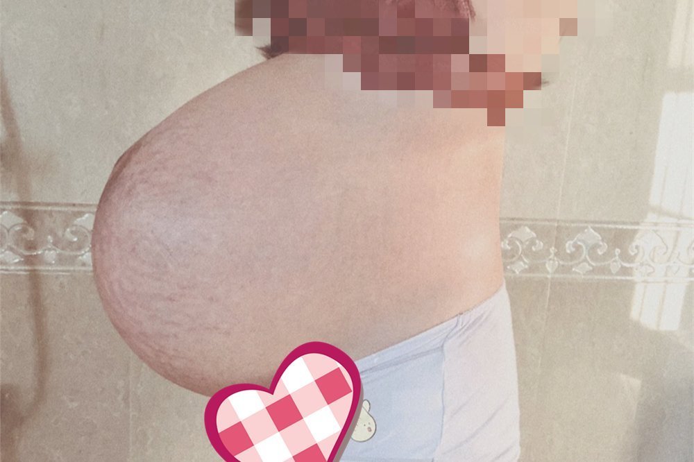 孕肚|“悬浮肚”多十产九剖,想要顺产过关有讲究,孕妈最好别强求