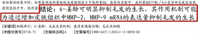 头皮 油头、脱发、有头屑怎么选洗发水？看完这篇就知道了