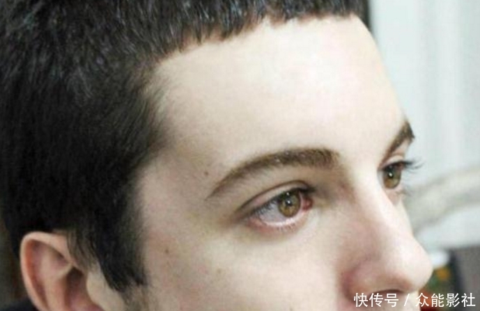 阿根廷一男子因痴迷于童话人物,竟花费240万整形成“精灵”