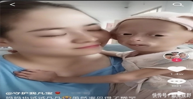 疼痛|七岁宝宝得了这种怪病,却不哭不闹帮妈妈照顾弟妹,疼痛时想睡觉