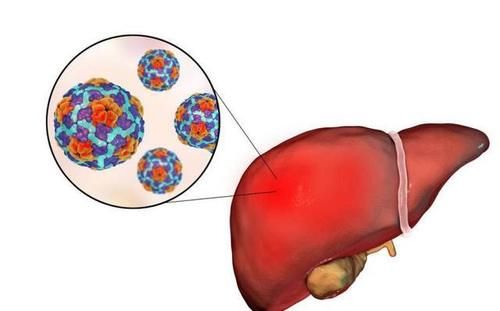 肝内科主任：转氨酶360半年降到32，坚持补1红，你也可以