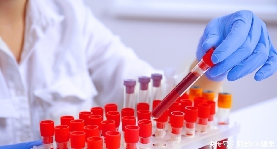 高血脂|退休院士提醒:血脂过高,戒掉2种食物,血脂或能下降了