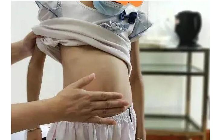 脾虚|孩子瘦弱不长肉,妈妈:等长大点就好了。儿科医生:极其不负责任