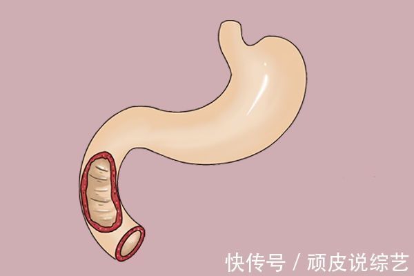 健脾|孩子不爱吃饭,健脾消食是关键,分清楚情况,调理起来或很简单