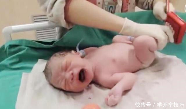 生娃|宝宝出生后被带走十几分钟,这段时间经历了什么组图带你看真相!