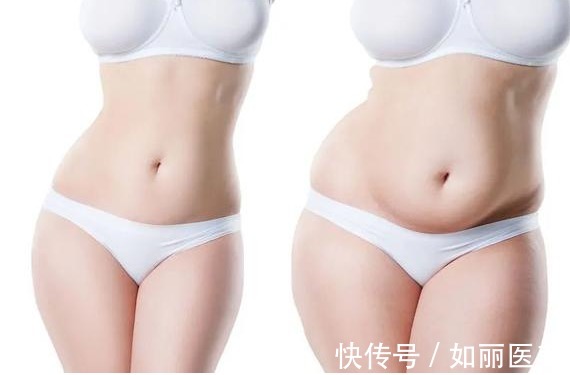 小手术 吸脂手术后穿塑身衣,居然有这么多细节需要注意?