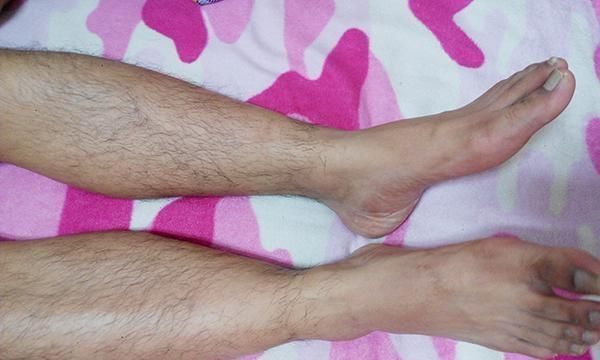 腿毛|为啥有的男性腿毛茂密，有人却“光秃秃”？两者有什么不同？