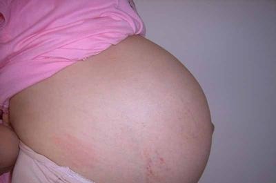 排泄物|孕妈在医院走廊突然生娃,急喊“快接住”,老公的表现让医生敬佩