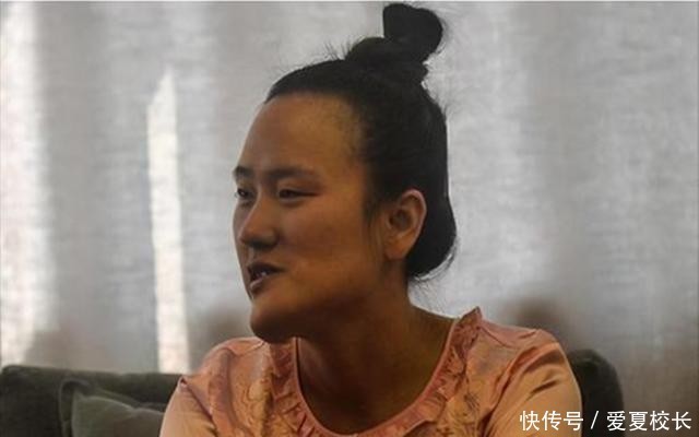 女神|“歪脸女孩”火了，受资助变身成女神，舍弃百万年薪赴西藏支教