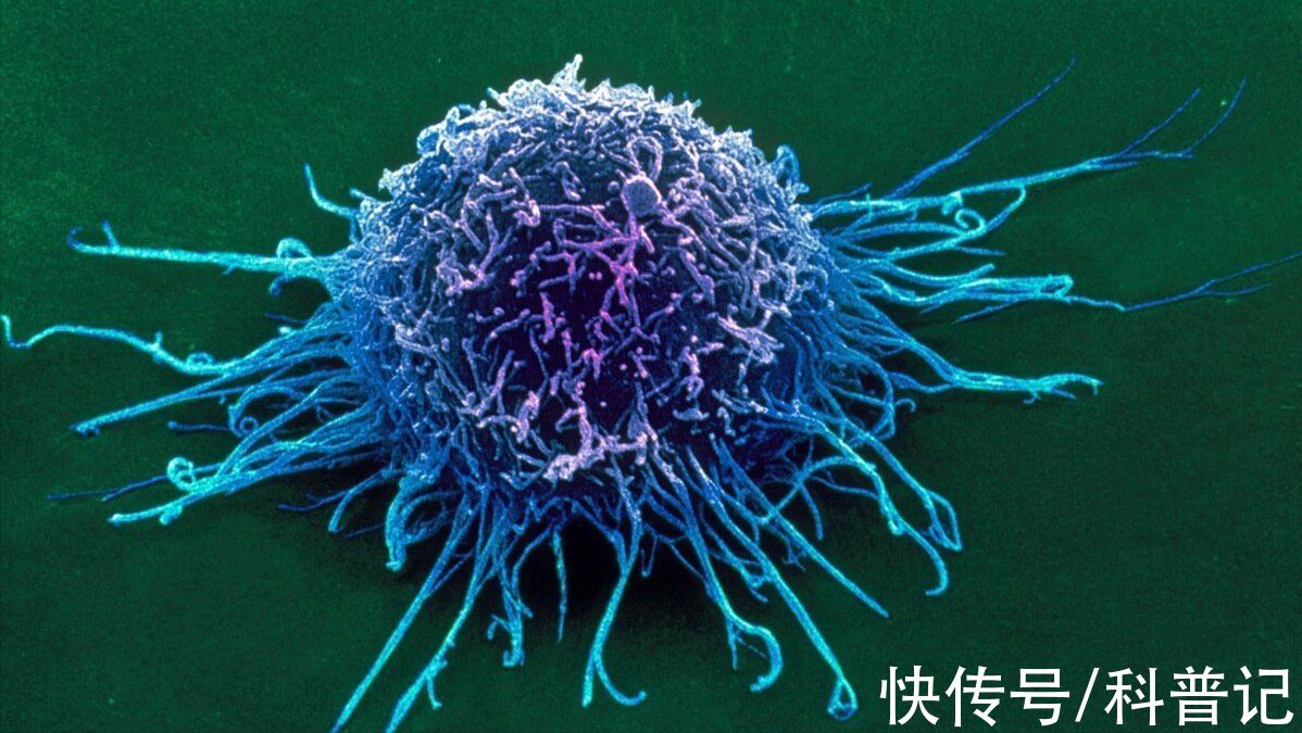 免疫细胞|癌细胞为什么这么顽固？假如吃下一块癌细胞，人体会发生什么？