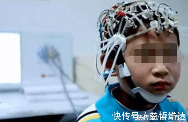 夫妻俩|6岁儿子过目不忘,老师夸他是天才,医生检查后,家长冒出一身汗