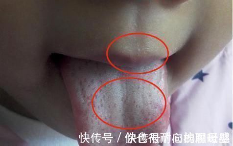 鸡内金|孩子积食都是惯出来的,这三件事是积食“加速器”,劝告父母少做