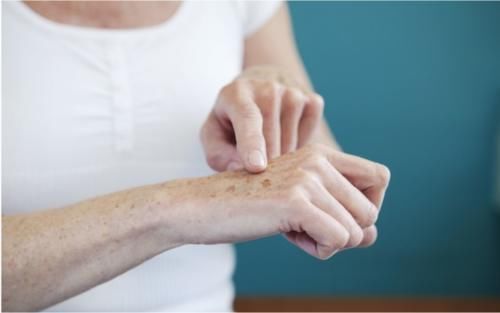 身体健康|为什么出现老年斑?是身体健康发出的信号?做好4事,远离色素斑