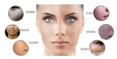 大干皮 水光针、微针、光子嫩肤、皮秒有什么作用,该怎么选?