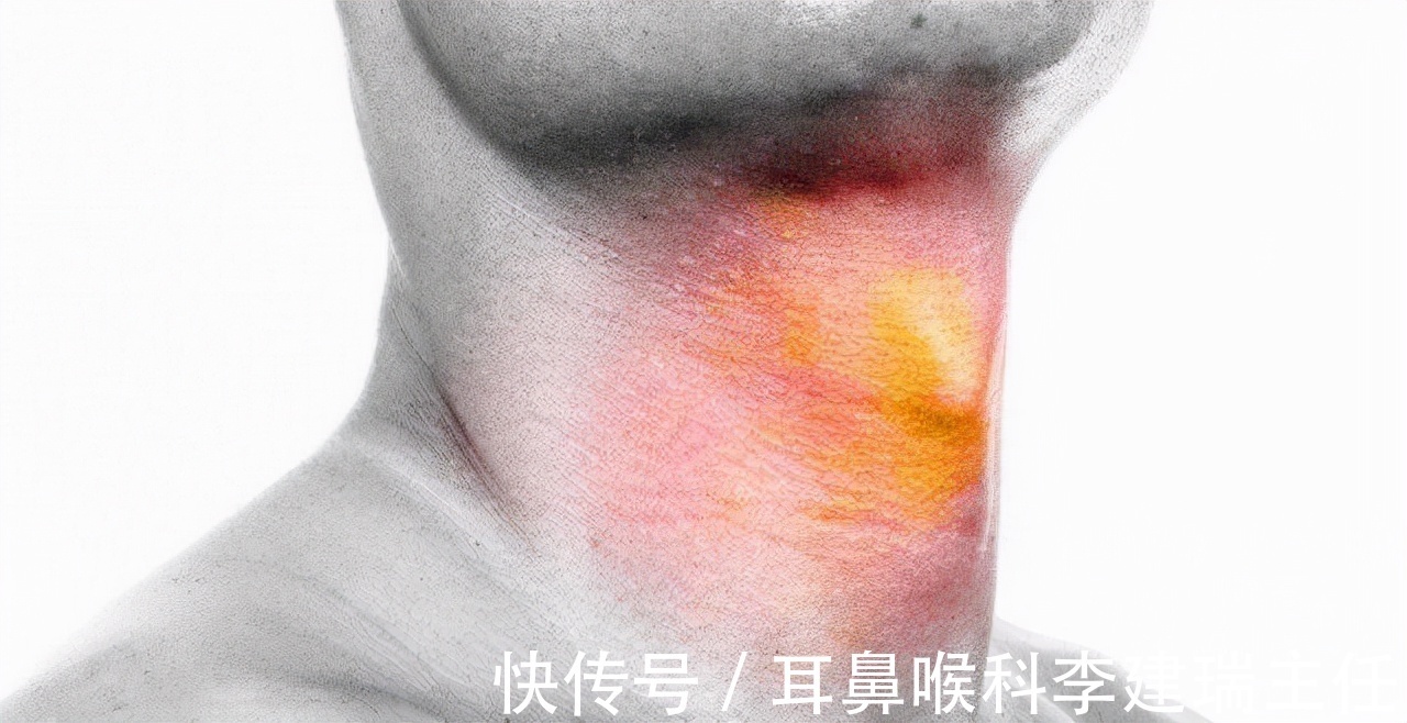 腺样体肥大|感冒要吃消炎药?擤鼻涕两只一起擤?那些年我们踩过的坑有多坑