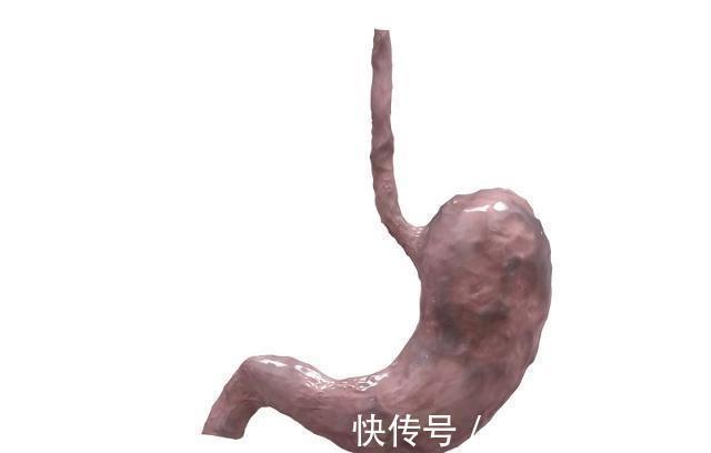 胃病|老中医:肠胃不好的人,4类食物再想吃也别碰,慢慢养出健康胃!